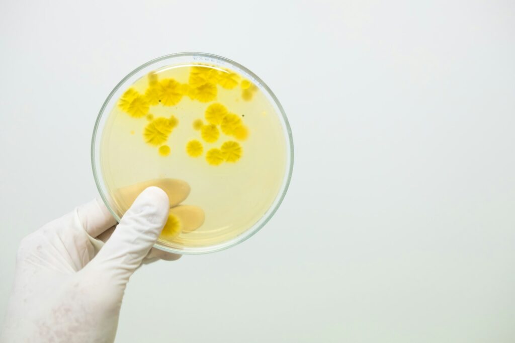 The microbiologist's hand wear white sterile glove is holding the plate contain the fungi colonies.